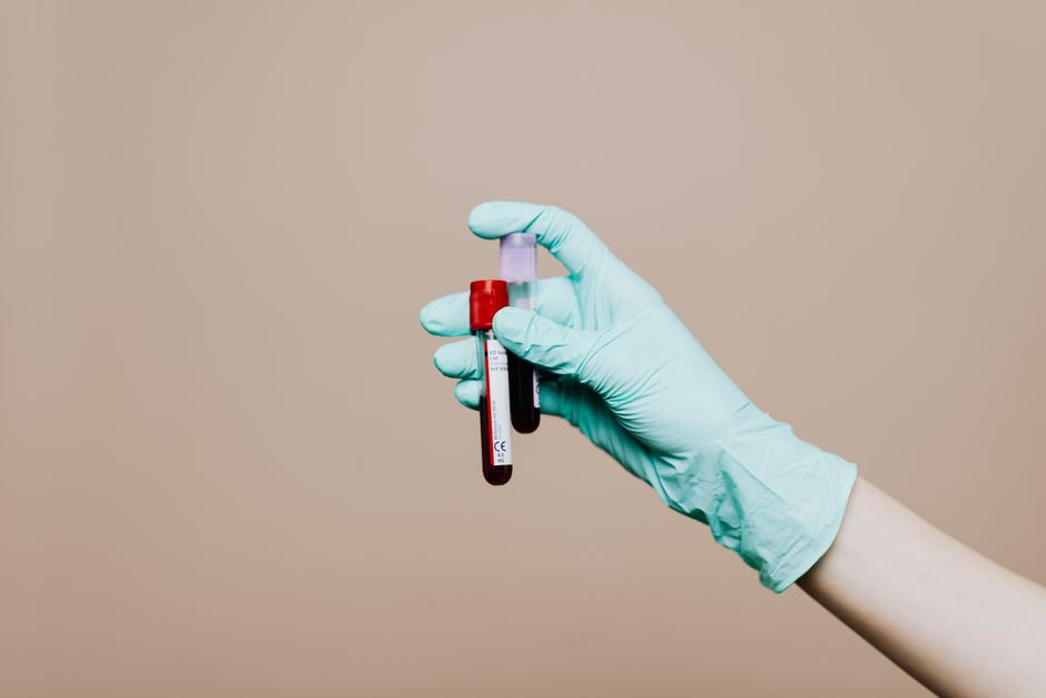 Blood test used to monitor nutrient levels after bariatric surgery